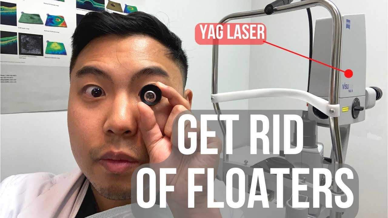 How to get rid of floaters in 2 MINUTES. (BUT IS IT SAFE?) | Ophthalmologist @MichaelRChuaMD